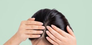 Нездорова шкіра голови: ознаки, причини та ефективні рішення