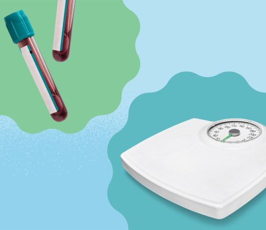 Більше, ніж просто цифри: чому зниження ваги може бути важливішим, ніж рівень A1C при контролі діабету 2 типу